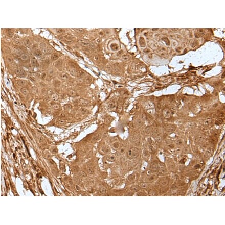 LIPG Antibody from Signalway Antibody (43517) - Antibodies.com