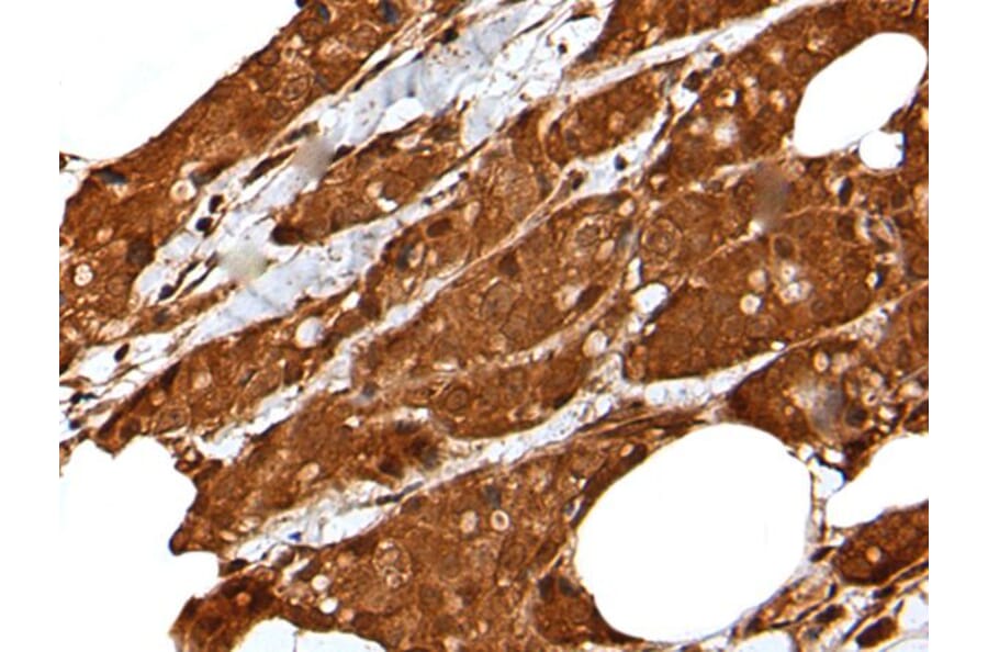 LIPG Antibody from Signalway Antibody (43517) - Antibodies.com