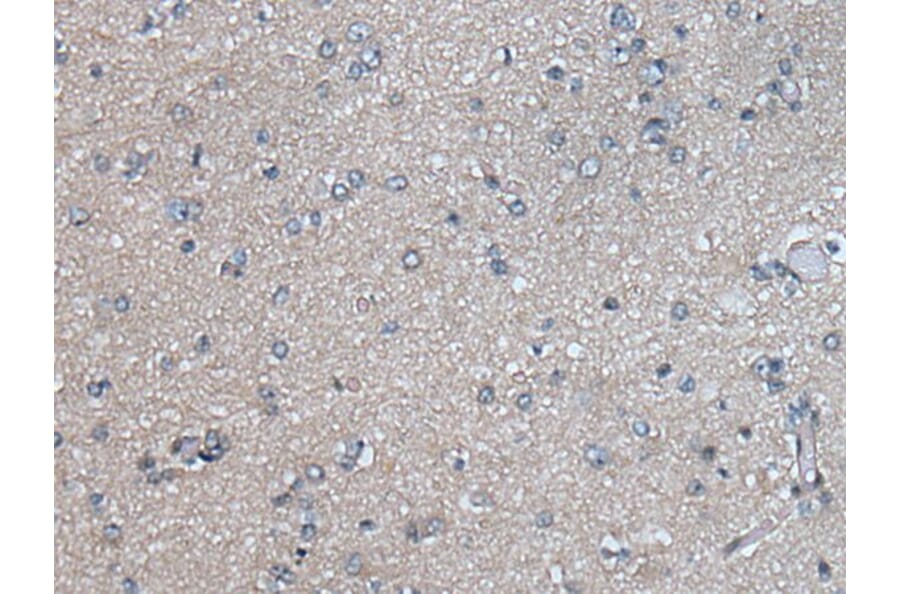 PLK4 Antibody from Signalway Antibody (43523) - Antibodies.com