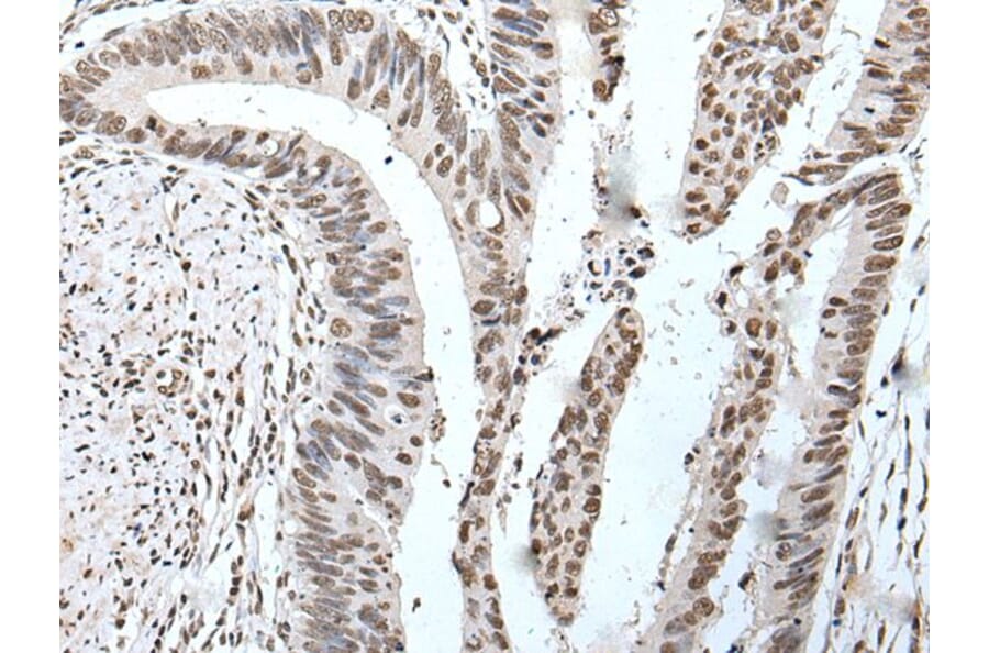 POT1 Antibody from Signalway Antibody (43524) - Antibodies.com