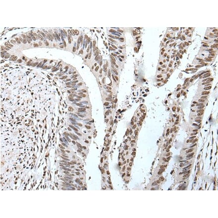 POT1 Antibody from Signalway Antibody (43524) - Antibodies.com