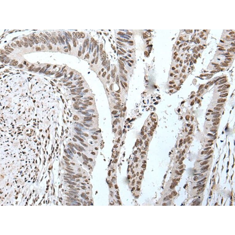 POT1 Antibody from Signalway Antibody (43524) - Antibodies.com