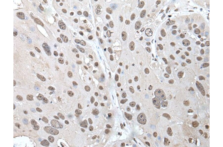 POT1 Antibody from Signalway Antibody (43524) - Antibodies.com