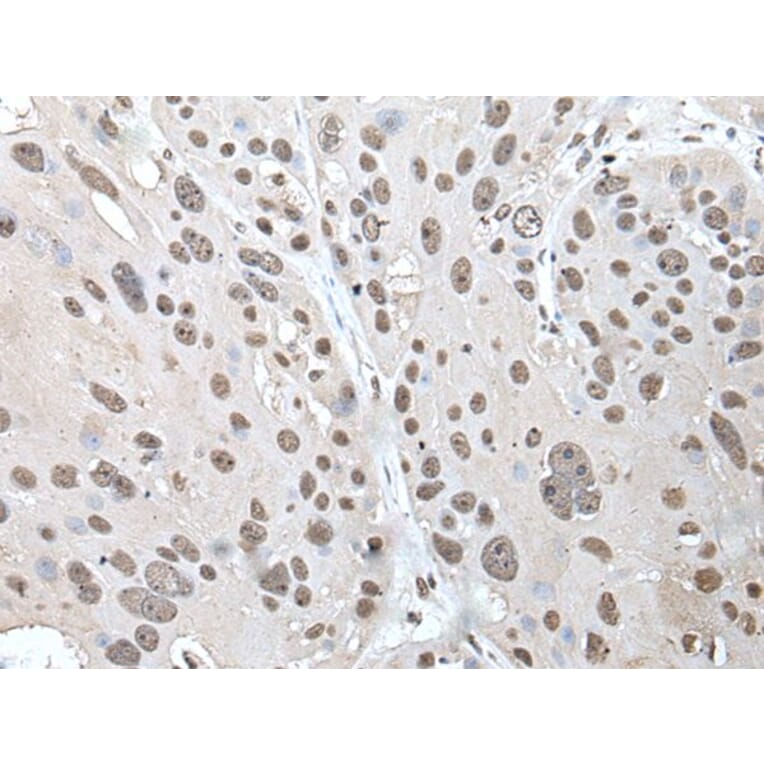 POT1 Antibody from Signalway Antibody (43524) - Antibodies.com