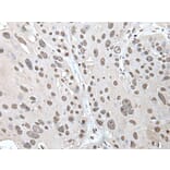 POT1 Antibody from Signalway Antibody (43524) - Antibodies.com