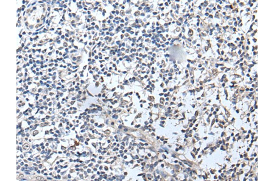 RERG Antibody from Signalway Antibody (43532) - Antibodies.com
