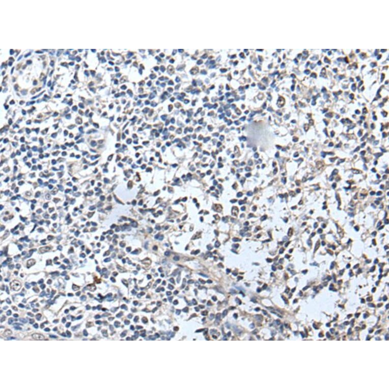 RERG Antibody from Signalway Antibody (43532) - Antibodies.com