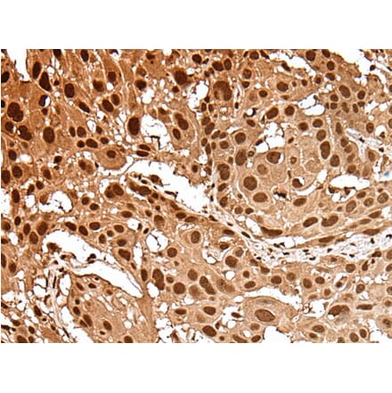 GAR1 Antibody from Signalway Antibody (43554) - Antibodies.com