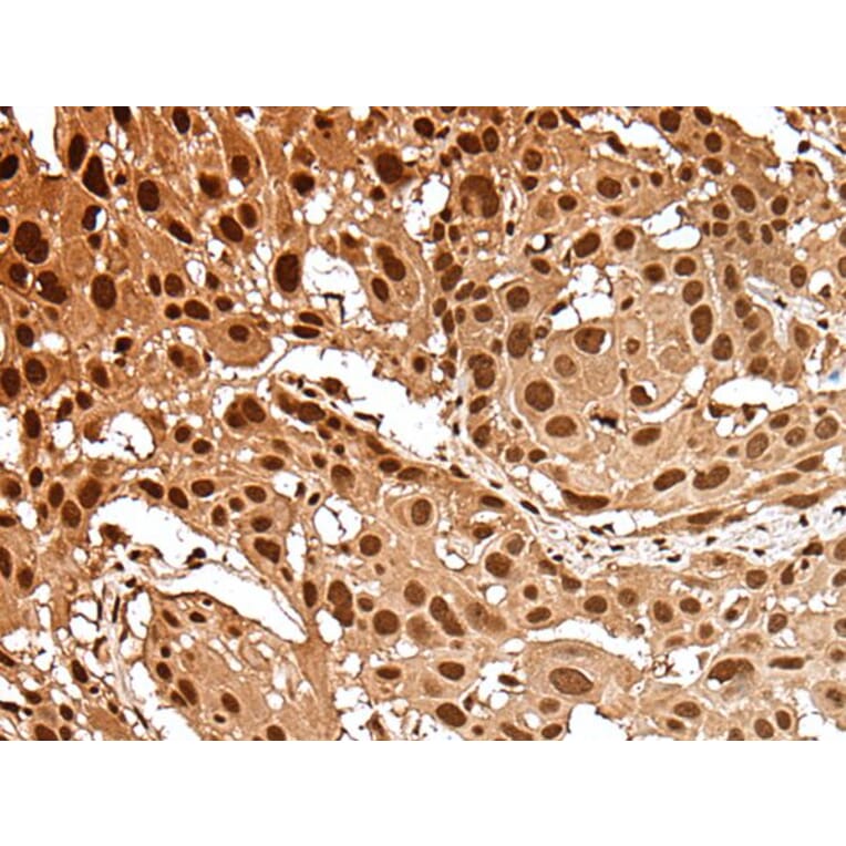 GAR1 Antibody from Signalway Antibody (43554) - Antibodies.com