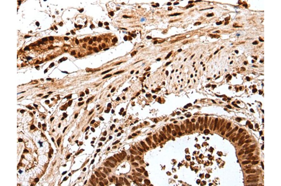GAR1 Antibody from Signalway Antibody (43554) - Antibodies.com