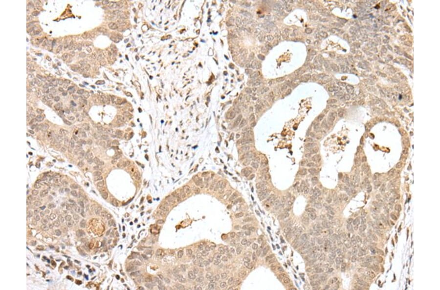 SNF8 Antibody from Signalway Antibody (43562) - Antibodies.com
