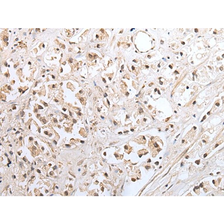 SNF8 Antibody from Signalway Antibody (43562) - Antibodies.com