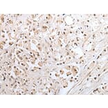 SNF8 Antibody from Signalway Antibody (43562) - Antibodies.com