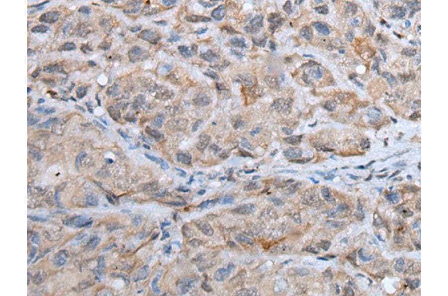 DPM1 Antibody from Signalway Antibody (43564) - Antibodies.com