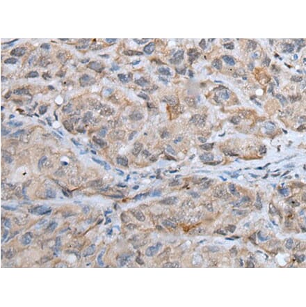 DPM1 Antibody from Signalway Antibody (43564) - Antibodies.com