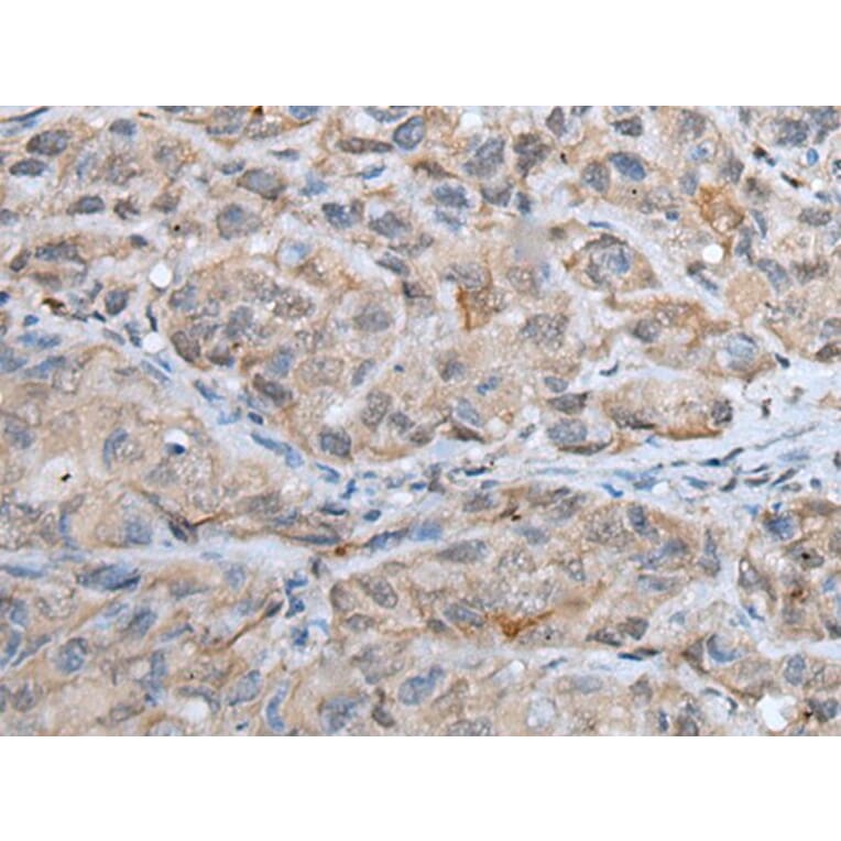 DPM1 Antibody from Signalway Antibody (43564) - Antibodies.com
