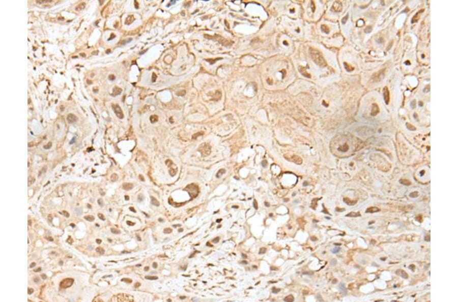 ZZZ3 Antibody from Signalway Antibody (43584) - Antibodies.com