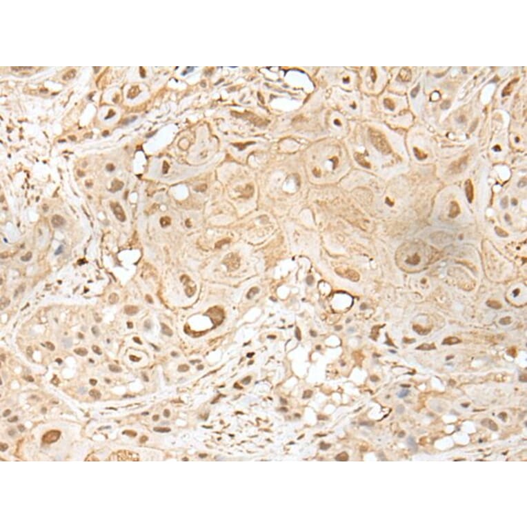 ZZZ3 Antibody from Signalway Antibody (43584) - Antibodies.com