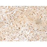 ZZZ3 Antibody from Signalway Antibody (43584) - Antibodies.com