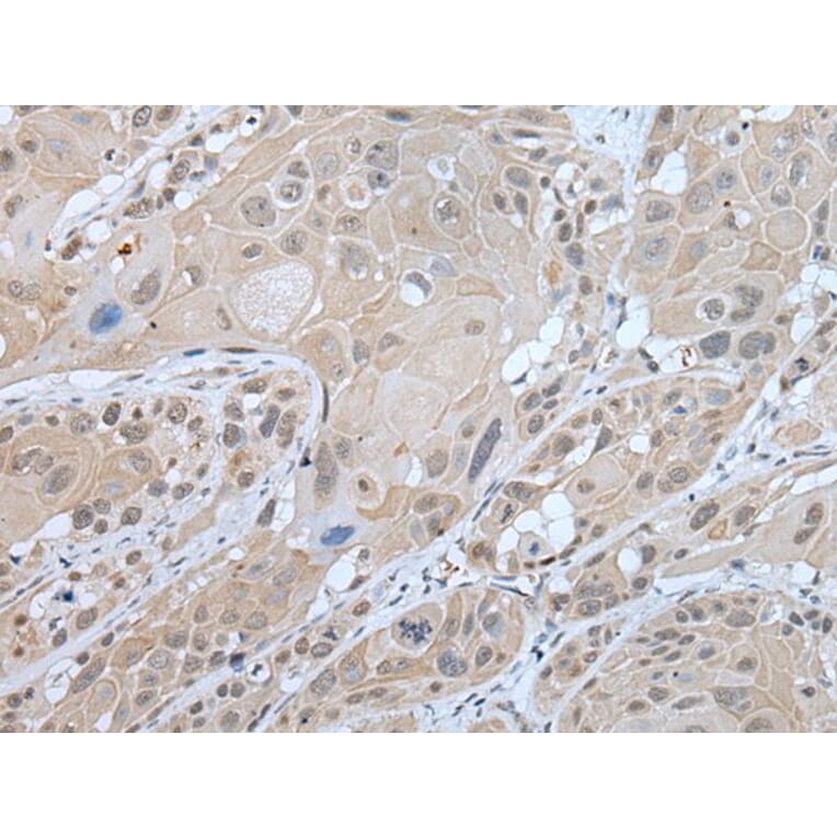 WFS1 Antibody from Signalway Antibody (43590) - Antibodies.com