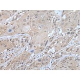 WFS1 Antibody from Signalway Antibody (43590) - Antibodies.com