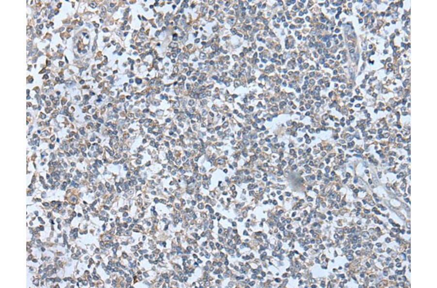 WFS1 Antibody from Signalway Antibody (43590) - Antibodies.com