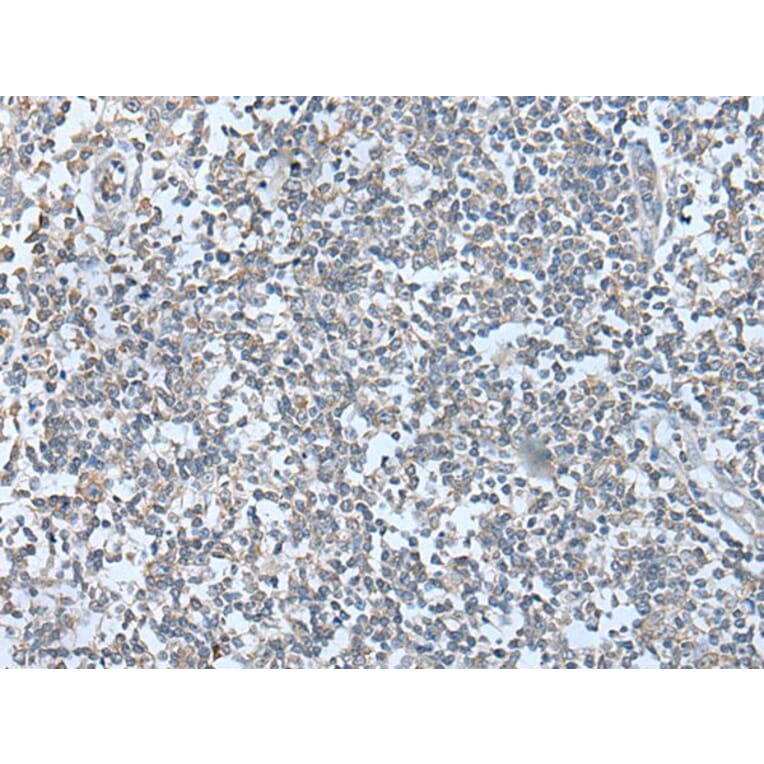 WFS1 Antibody from Signalway Antibody (43590) - Antibodies.com