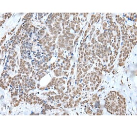 WTAP Antibody from Signalway Antibody (43592) - Antibodies.com