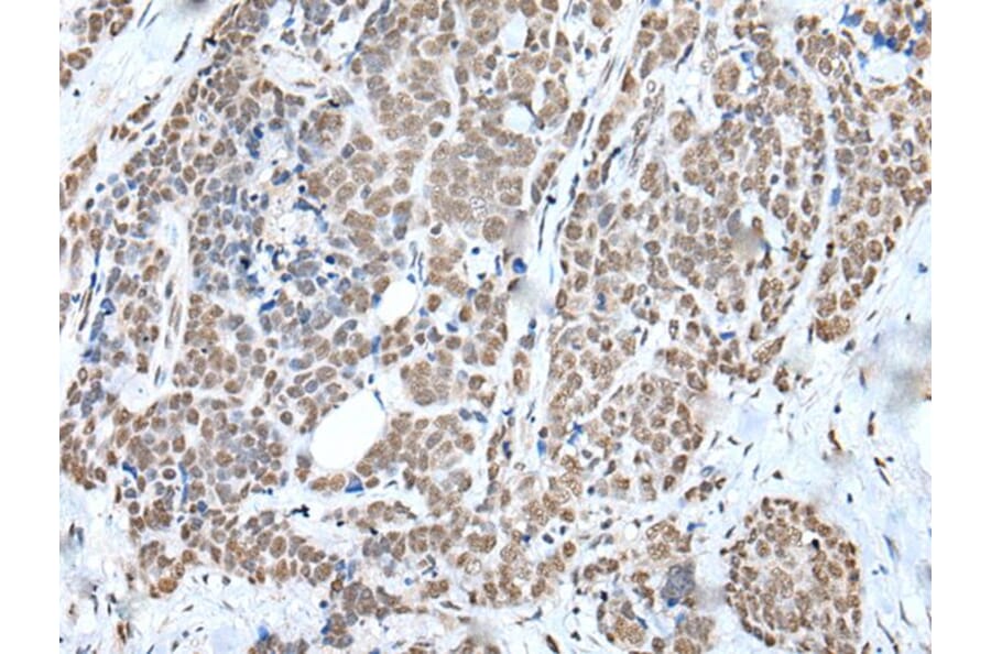 WTAP Antibody from Signalway Antibody (43592) - Antibodies.com