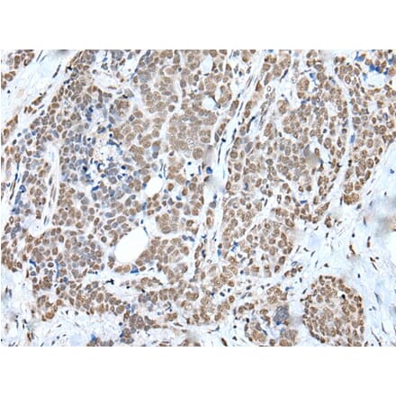 WTAP Antibody from Signalway Antibody (43592) - Antibodies.com