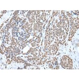 WTAP Antibody from Signalway Antibody (43592) - Antibodies.com