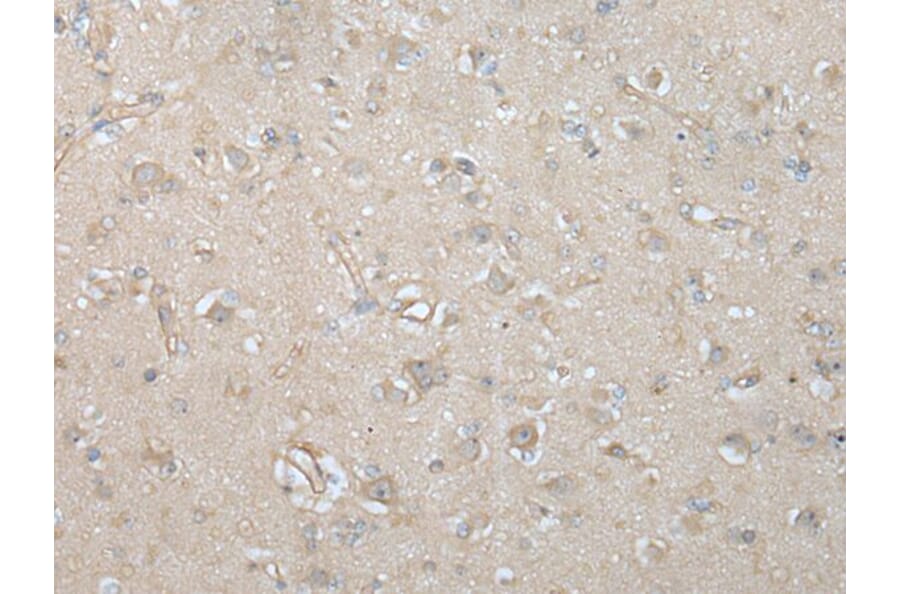 VILL Antibody from Signalway Antibody (43593) - Antibodies.com