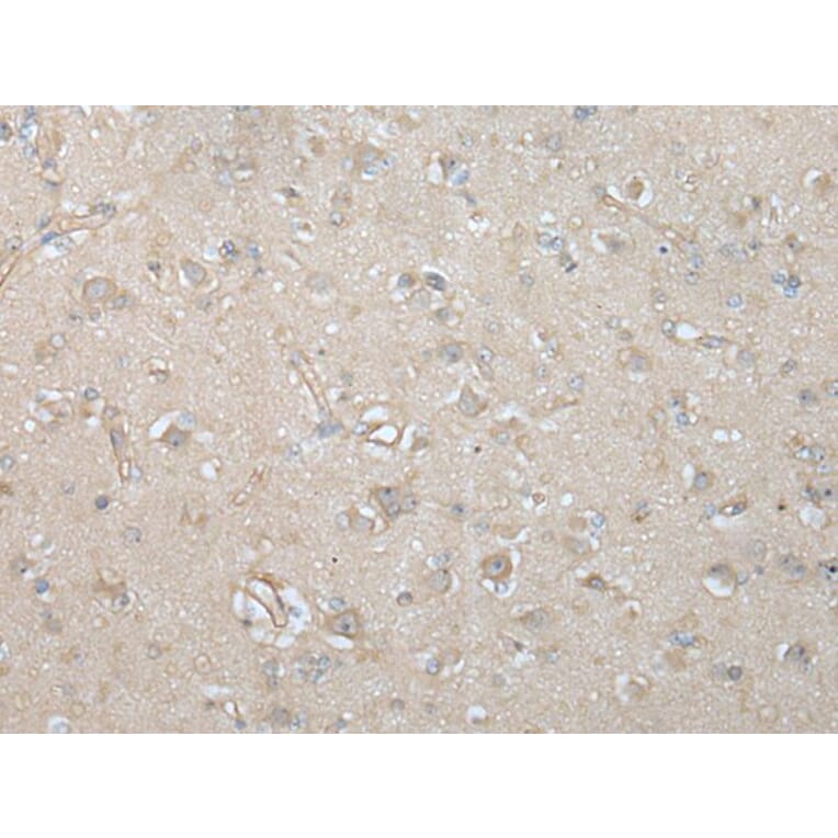 VILL Antibody from Signalway Antibody (43593) - Antibodies.com