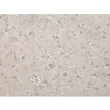 VILL Antibody from Signalway Antibody (43593) - Antibodies.com