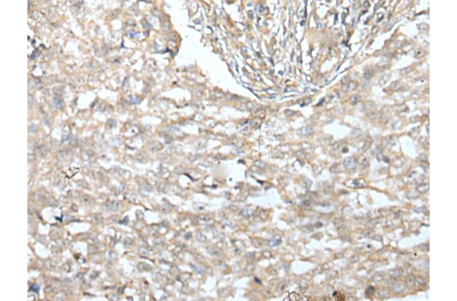 VILL Antibody from Signalway Antibody (43593) - Antibodies.com