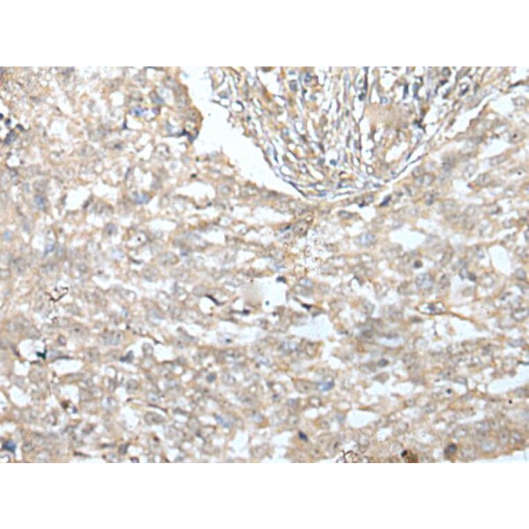 VILL Antibody from Signalway Antibody (43593) - Antibodies.com