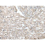 VILL Antibody from Signalway Antibody (43593) - Antibodies.com