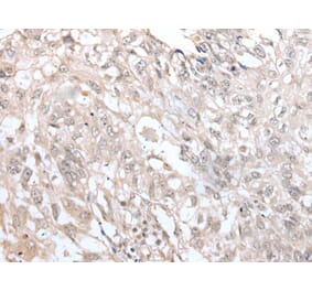 VRK3 Antibody from Signalway Antibody (43596) - Antibodies.com