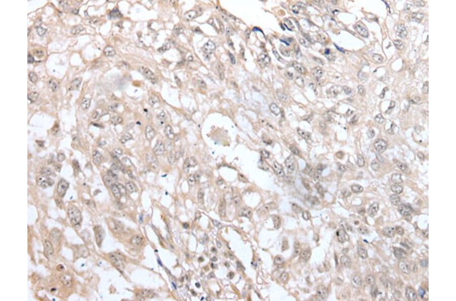 VRK3 Antibody from Signalway Antibody (43596) - Antibodies.com