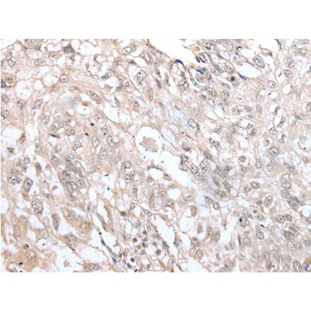 VRK3 Antibody from Signalway Antibody (43596) - Antibodies.com