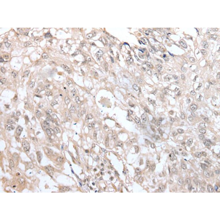 VRK3 Antibody from Signalway Antibody (43596) - Antibodies.com