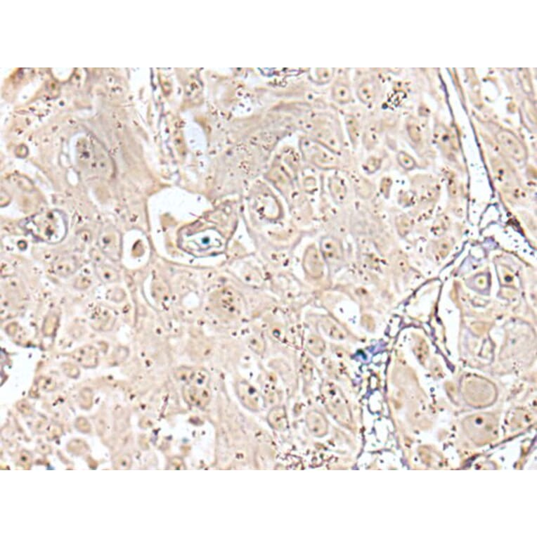 VRK3 Antibody from Signalway Antibody (43596) - Antibodies.com