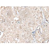 VRK3 Antibody from Signalway Antibody (43596) - Antibodies.com