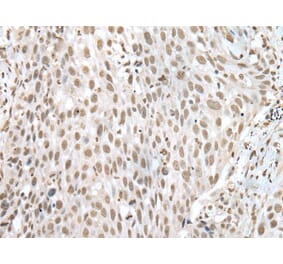 VSX1 Antibody from Signalway Antibody (43597) - Antibodies.com