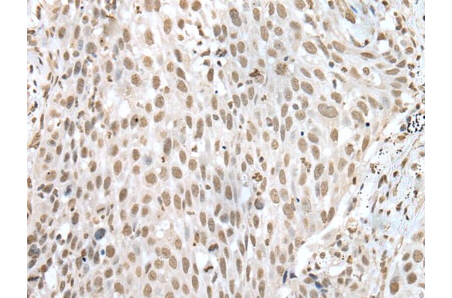 VSX1 Antibody from Signalway Antibody (43597) - Antibodies.com