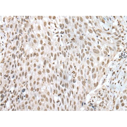 VSX1 Antibody from Signalway Antibody (43597) - Antibodies.com