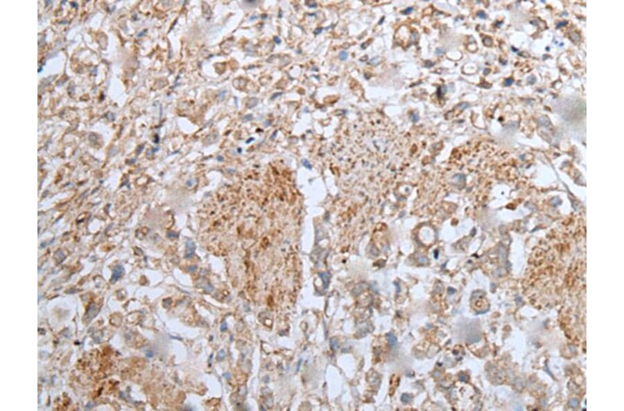 UBA6 Antibody from Signalway Antibody (43598) - Antibodies.com