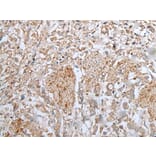 UBA6 Antibody from Signalway Antibody (43598) - Antibodies.com