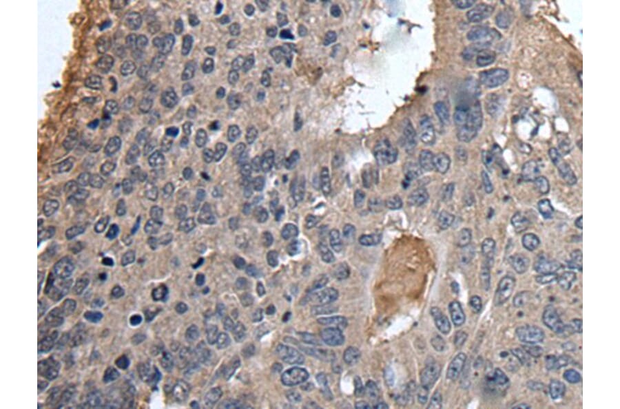 UBR2 Antibody from Signalway Antibody (43611) - Antibodies.com