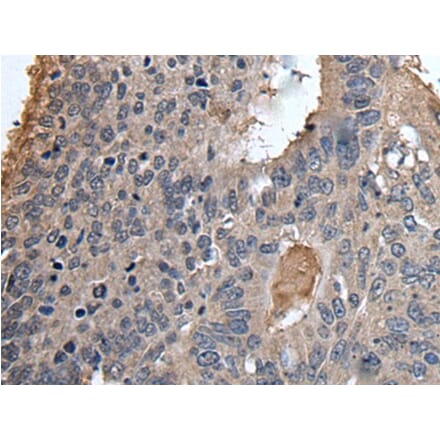 UBR2 Antibody from Signalway Antibody (43611) - Antibodies.com